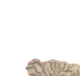 1 Schmallenberg